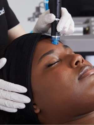 Oxygen Blast (Hydrafacial)