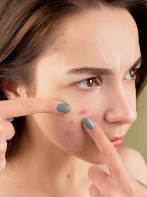 Acne Fighting(HF)